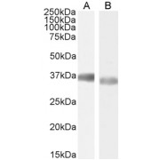abx432731 (0.001 µg/ml) staining of HEK293 (A) and HeLa (B) cell lysate (35 µg protein in RIPA buffer). Detected by chemiluminescence.