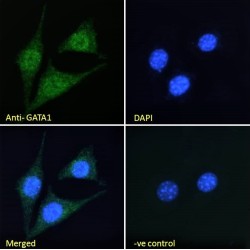 GATA Binding Protein 1 (GATA1) Antibody