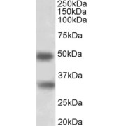 abx432741 (1 µg/ml) staining of Human Spleen lysate (35 µg protein in RIPA buffer). Primary incubation was 1 hour. Detected by chemiluminescence.