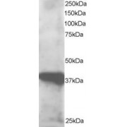abx432748 staining (0.5 µg/ml) of human lymph node lysate (RIPA buffer, 30 µg total protein per lane). Primary incubated for 1 hour. Detected by western blot using chemiluminescence.