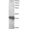 PDZ Domain-Containing Protein GIPC3 (GIPC3) Antibody
