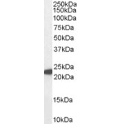 abx432753 (1 µg/ml) staining of Human Liver lysate (35 µg protein in RIPA buffer). Primary incubation was 1 hour. Detected by chemiluminescence.