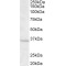 Guanine Nucleotide-Binding Protein G(I)/G(S)/G(T) Subunit Beta-3 (GNB3) Antibody