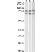 abx432758 (2 µg/ml) staining of HeLa (A)HepG2 (B) and K562 (C) nuclear lysates (35 µg protein in RIPA buffer). Primary incubation was 1 hour. Detected by chemiluminescence.