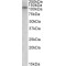 Glutamate Receptor Ionotropic, NMDA 3B (GRIN3B) Antibody