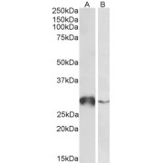 abx432780 (0.5 µg/ml) staining of Human Liver (A) and Peripheral Blood Lymphocytes (B) lysates (35 µg protein in RIPA buffer). Primary incubation was 1 hour. Detected by chemiluminescence.
