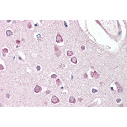 Huntingtin Associated Protein 1 (HAP1) Antibody