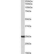 abx432789 (0.3 µg/ml) staining of Human Amygdala lysate (35 µg protein in RIPA buffer). Primary incubation was 1 hour. Detected by chemiluminescence.