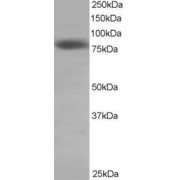 abx432790 staining (0.5 µg/ml) of Hela lysate (RIPA buffer, 35 µg total protein per lane). Primary incubated for 1 hour. Detected by chemiluminescence.