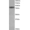 Highly Expressed In Cancer Protein (HEC1) Antibody
