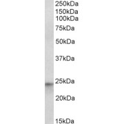 abx432793 (1 µg/ml) staining of HepG2 nuclear lysate (35 µg protein in RIPA buffer). Primary incubation was 1 hour. Detected by chemiluminescence.