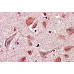 Huntingtin Interacting Protein 2 (HIP2) Antibody