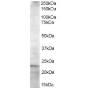 abx432794 staining (1.5 µg/ml) of Jurkat lysate (RIPA buffer, 35 µg total protein per lane). Primary incubated for 1 hour. Detected by western blot using chemiluminescence.