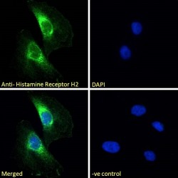 Histamine Receptor H2 Antibody