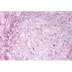 HLA class I histocompatibility antigen, B alpha chain (HLA-B) Antibody