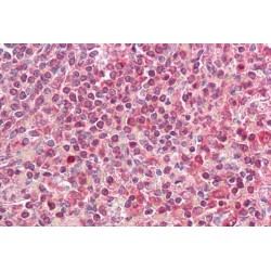 HLA Class II Histocompatibility Antigen, DQ Alpha 2 Chain (HLA-DQA2) Antibody