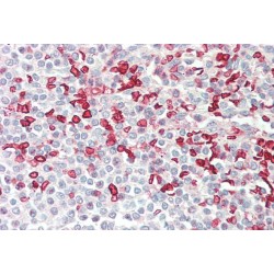 Porphobilinogen Deaminase (HMBS) Antibody