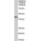 Porphobilinogen Deaminase (HMBS) Antibody