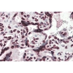 High Mobility Group Protein HMG-I/HMG-Y (HMGA1) Antibody