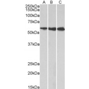 abx432806 (1 µg/ml) staining of HeLa (A), HepG2 (B) and K562 (C) lysates (35 µg protein in RIPA buffer). Primary incubation was 1 hour. Detected by chemiluminescence.