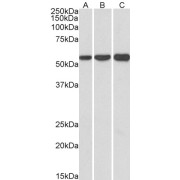 abx432807 (1 µg/ml) staining of HeLa (A), HepG2 (B) and K562 (C) lysates (35 µg protein in RIPA buffer). Primary incubation was 1 hour. Detected by chemiluminescence.