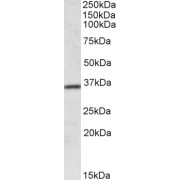 abx432812 (0.1 µg/ml) staining of Human Colon lysate (35 µg protein in RIPA buffer). Primary incubation was 1 hour. Detected by chemiluminescence.