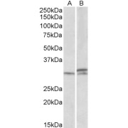 abx432814 (1 µg/ml) staining of Mouse and Rat Spinal Cord lysates (35 µg protein in RIPA buffer). Primary incubation was 1 hour. Detected by chemiluminescence.