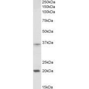 abx432815 (2 µg/ml) staining of Moue Spleen lysate (35 µg protein in RIPA buffer). Primary incubation was 1 hour. Detected by chemiluminescence.