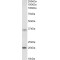 Homeobox Protein Hox-A9 (HOXA9) Antibody