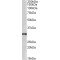 Testosterone 17-Beta-Dehydrogenase 3 (HSD17B3) Antibody