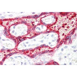 3 Beta-Hydroxysteroid Dehydrogenase/Delta 5-->4-Isomerase Type 1 (HSD3B1) Antibody