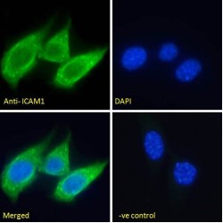 Intercellular Adhesion Molecule 1 (ICAM1) Antibody