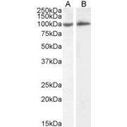 abx432833 (2 µg/ml) staining of HeLa (A) and Daudi (B) cell lysate (35 µg protein in RIPA buffer). Primary incubation was 1 hour. Detected by chemiluminescence.