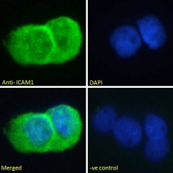 Intercellular Adhesion Molecule 1 (ICAM1) Antibody