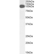 abx432834 (0.3 µg/ml) staining of Human Lung lysate (35 µg protein in RIPA buffer). Detected by chemiluminescence.