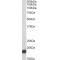 Interferon-Induced Transmembrane Protein 3 (IFITM3) Antibody