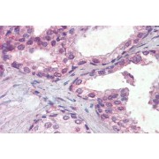 abx432843 (5 µg/ml) staining of paraffin embedded Human Prostate. Steamed antigen retrieval with citrate buffer Ph 6, AP-staining.