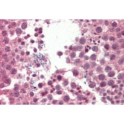 Insulin Like Growth Factor Binding Protein 1 (IGFBP1) Antibody