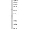 Insulin Like Growth Factor Binding Protein 1 (IGFBP1) Antibody