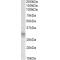 Insulin Like Growth Factor Binding Protein 7 (IGFBP7) Antibody
