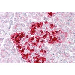 Insulin Like Growth Factor Binding Protein 7 (IGFBP7) Antibody