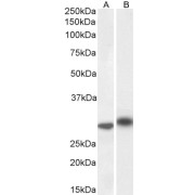WB analysis of Human PBM (A) and Bone Marrow (B) lysate using IL1B Antibody (1 µg/ml).