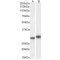 Interleukin-1 Beta (IL1B) Antibody