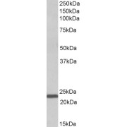 abx432855 (1 µg/ml) staining of Human Bone Marrow lysate (35 µg protein in RIPA buffer). Primary incubation was 1 hour. Detected by chemiluminescence.