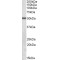 Integrin-Linked Protein Kinase (ILK) Antibody