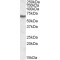Inosine 5'-Monophosphate Dehydrogenase 2 (IMPDH2) Antibody