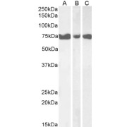 abx432869 (1 µg/ml) staining of Human Pancreas (A), Heart (B) and Skeletal Muscle (C) lysates (35 µg protein in RIPA buffer). Primary incubation was 1 hour. Detected by chemiluminescence.