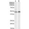 Interferon Regulatory Factor 4 (IRF4) Antibody