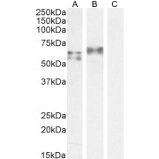 abx432874 staining (1 µg/ml) Human Spleen (A) and A549 cell lysate (B) + peptide (C). (35 µg protein in RIPA buffer). Detected by chemiluminescence.