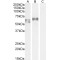 Interferon Regulatory Factor 5 (IRF5) Antibody